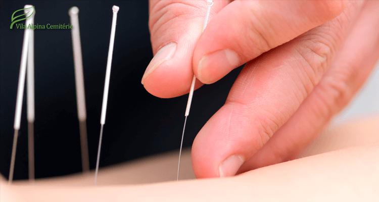 imagem com mão colocando agulhas de acupuntura no corpo